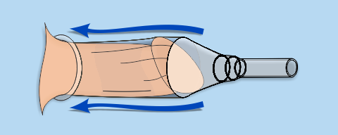 530135 Diagram